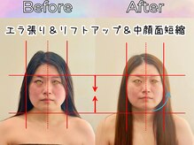 天空の手もみ/小顔矯正/吉祥寺/荻窪/西荻窪