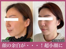 アクアビー(AQUA-B)/