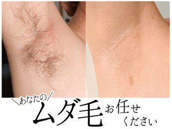 スポット 薬院駅前店(SPOT)/ワキ脱毛などのムダ毛も柔軟対応