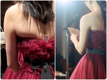 ヨサパーク ビウィズ(YOSAPARK 美 with)の写真/上半身集中痩身!ハミ肉、むくみ解消、冷え固まった頑固な脂肪もスッキリ!ほっそり二の腕に!