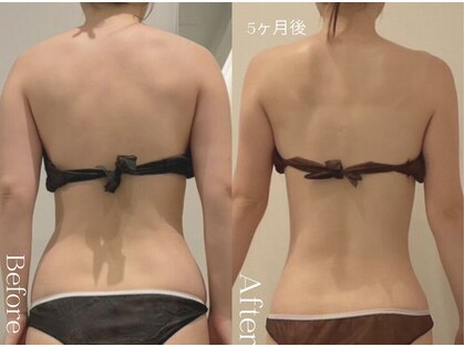 ユーフォリア グロウ(euphoria glow)の写真