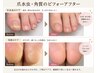 【徹底的に改善】角質・肥厚爪のケア+フットケア 60分