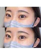 コレットアイビューティー(COLLET EYE BEAUTY)/