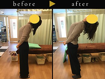 杉本接骨鍼灸院/背骨から全身がユルユル整体