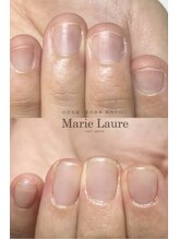 マリーロール 天王寺店(Marie Laure)/自爪育成/深爪矯正/ネイルケア