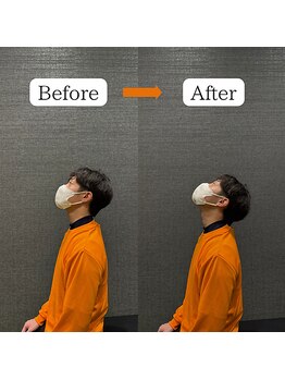 ビーストレッチ イオンモール土岐店(Beeストレッチ)/首こり/肩こりに◎