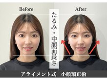 アライメント 自由が丘(Alignment)