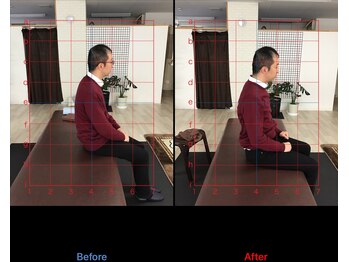 ストレチックス 近江八幡店/姿勢・膝痛改善ビフォーアフター