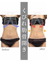 ステイゴールド美容整体院(STAY GOLD)/夏に向けてくびれ作りませんか？