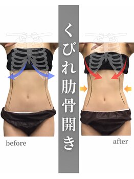 ステイゴールド美容整体院(STAY GOLD)/夏に向けてくびれ作りませんか？