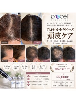 リサイド アオ クマガヤ(RESIDE AO KUMAGAYA)の写真/薄くなった頭皮に