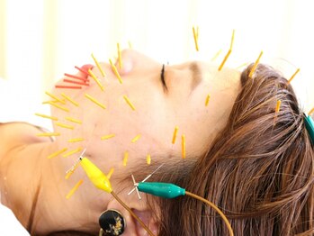 サニー(SUNNY)/電気美容鍼で肌悩み改善◎