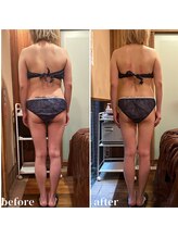 ビューティースタイリング 自由が丘店(beauty styling)/【驚きの効果】