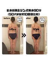 シェルシア(Cielcia)/全身筋膜＆リンパ痩身９０分