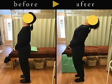 杉本接骨鍼灸院/背骨から全身がユルユル整体