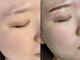 リンダ(Linda)の写真/お顔の印象は目元から！眉毛のお手入れでお顔の印象がガラリと変わります♪プロの技術で理想的な形に！