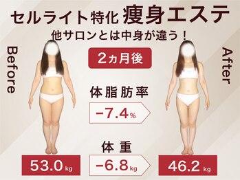 ラ パルレ 京都本店/全身セルライトケア