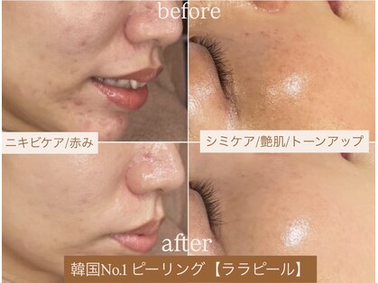 タイズレリーフ(TIES RELIEF)の写真