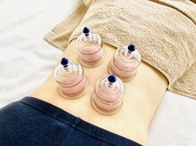 岡町おうち鍼灸整骨院の雰囲気(カッピングで血流スッキリ!初めての方にもおすすめ◎)