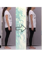 セプトきらく鍼灸整体院(Sept.)/前後の変化！！