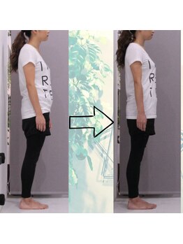 セプトきらく鍼灸整体院(Sept.)/前後の変化!!