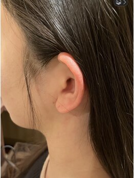 エステアンドヘアーサロン アルテ 札幌/自然なもみあげ脱毛好評