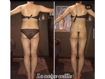 ラネージュミル(La neige mille)/インキュア痩身