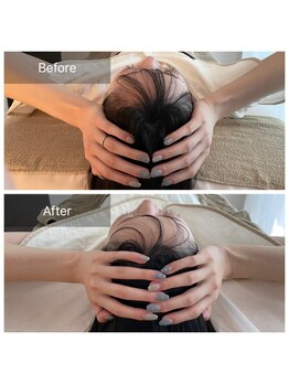 ティセ(TisseR)/脳洗浄100分