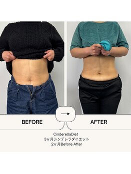 オーシャン整骨院(OCEAN整骨院)/ダイエット3ヶ月コース