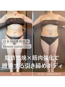 リコ 白金台(Liko)/ビフォーアフター