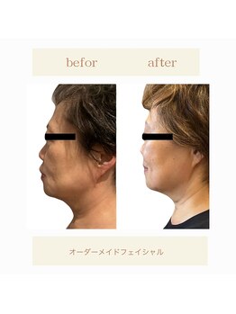 ビューティーマックス エースタジオ(Beauty MAX Astudio)/同業者にもファン多数のマシン