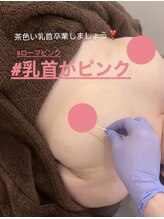 ヴィーナス(Venus)/ローマピンク