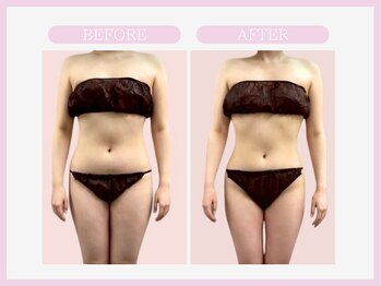 スリムライン 八戸店(The Slim Line)/before→after