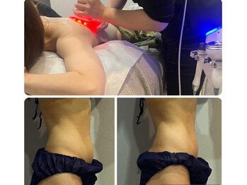 ラヴィエール(Laviere)/【レディース痩身】