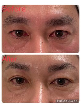 サムライの美/目元ケア症例写真