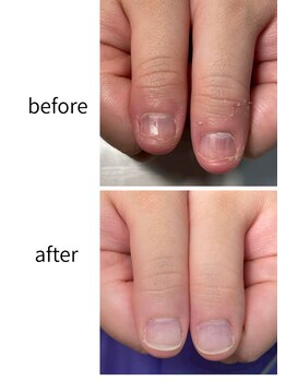 アールインネイル(R-in Nail)/自爪育成メニュー