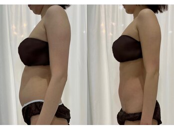 ファスール(Hwasoeur)/