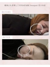 ヨサパーク ブーケ 代々木店(YOSA PARK bouquet)/before/after