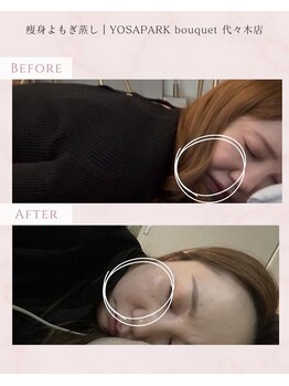 ヨサパーク ブーケ 代々木店(YOSA PARK bouquet)/before/after