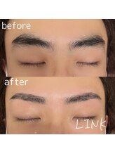 リンク(LINK)/眉毛症例