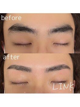 リンク(LINK)/眉毛症例