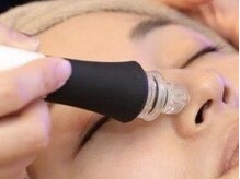 ラフレ(Rafre)/人気の毛穴洗浄コース