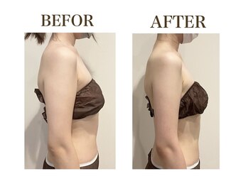 ルアバイアロ(Lua by Alo's)/ブライダルエステ