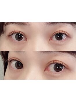 まつげのお悩み解決サロン