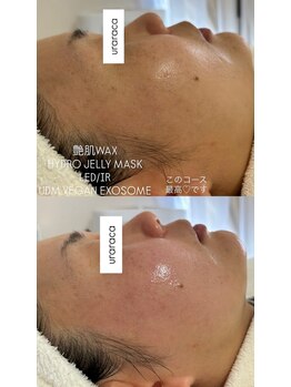 ウララカ(uraraca)/感動体験!