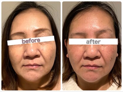 ハロースック 六本木(Hellossook)の写真