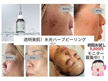 ナトゥーラ(NatuLa)/ハーブピーリング導入！