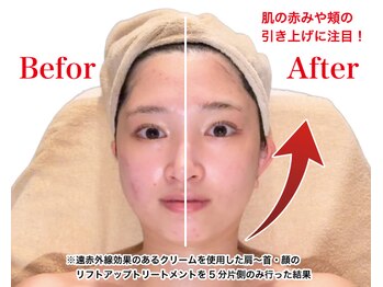 VS28スキンケアスタジオ バリイン 久留米(BALI IN)