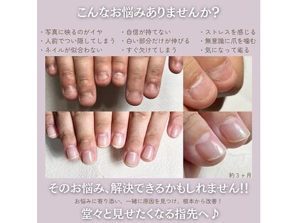 イズム(Izm)の写真