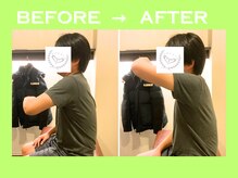 こころ整骨院/30代男性のビフォーアフター